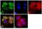 Cytokeratin antibody, MA5-13144, Invitrogen Antibodies, Immunofluorescence image 