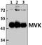Mevalonate Kinase antibody, PA5-75288, Invitrogen Antibodies, Western Blot image 