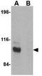 Junctophilin 3 antibody, GTX85366, GeneTex, Western Blot image 