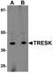 Potassium Two Pore Domain Channel Subfamily K Member 18 antibody, orb94355, Biorbyt, Western Blot image 
