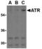 ANTXR Cell Adhesion Molecule 1 antibody, MBS150244, MyBioSource, Western Blot image 