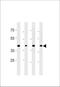 Cdk5 And Abl Enzyme Substrate 2 antibody, LS-C204007, Lifespan Biosciences, Western Blot image 