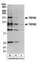 Transient Receptor Potential Cation Channel Subfamily M Member 2 antibody, A300-414A, Bethyl Labs, Western Blot image 