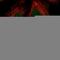 Ski2 Like RNA Helicase antibody, HPA051959, Atlas Antibodies, Immunofluorescence image 