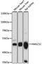 3-Hydroxy-3-Methylglutaryl-CoA Synthase 2 antibody, A14244, ABclonal Technology, Western Blot image 