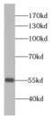 Calcium/Calmodulin Dependent Protein Kinase II Gamma antibody, FNab01235, FineTest, Western Blot image 