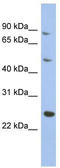Matrilin 3 antibody, TA337662, Origene, Western Blot image 