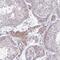 Zinc Finger And SCAN Domain Containing 9 antibody, HPA059951, Atlas Antibodies, Immunohistochemistry frozen image 