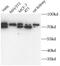 LIM Domain Containing Preferred Translocation Partner In Lipoma antibody, FNab10741, FineTest, Western Blot image 