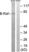 Serine/threonine-protein kinase B-raf antibody, TA326069, Origene, Western Blot image 