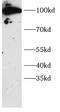 Denticleless protein homolog antibody, FNab10365, FineTest, Western Blot image 