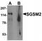 Small G Protein Signaling Modulator 2 antibody, TA319798, Origene, Western Blot image 
