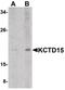 Potassium Channel Tetramerization Domain Containing 15 antibody, PA5-20702, Invitrogen Antibodies, Western Blot image 