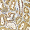 RAB1B, Member RAS Oncogene Family antibody, A7514, ABclonal Technology, Immunohistochemistry paraffin image 