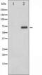 Ribosomal Protein S6 Kinase B1 antibody, TA325827, Origene, Western Blot image 