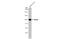 Minichromosome Maintenance Complex Component 3 antibody, GTX110241, GeneTex, Western Blot image 