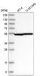 Hsp110 antibody, NBP2-76533, Novus Biologicals, Western Blot image 