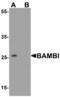 BMP and activin membrane-bound inhibitor homolog antibody, MBS153526, MyBioSource, Western Blot image 
