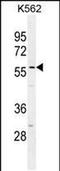 Smoothelin Like 1 antibody, PA5-48211, Invitrogen Antibodies, Western Blot image 
