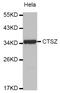 Cathepsin Z antibody, abx006736, Abbexa, Western Blot image 