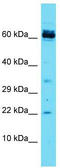 Coiled-Coil Domain Containing 115 antibody, TA342946, Origene, Western Blot image 