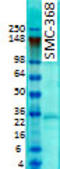 Potassium Voltage-Gated Channel Interacting Protein 2 antibody, TA326563, Origene, Western Blot image 