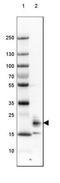 Uncharacterized protein C1orf93 homolog antibody, NBP1-93498, Novus Biologicals, Western Blot image 