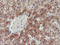 PHD Finger Protein 21B antibody, M16476, Boster Biological Technology, Immunohistochemistry paraffin image 