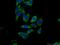 DAZ Interacting Zinc Finger Protein 1 antibody, 13779-1-AP, Proteintech Group, Immunofluorescence image 