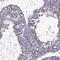 Zinc Finger Protein 646 antibody, NBP2-68841, Novus Biologicals, Immunofluorescence image 