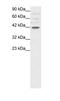POU domain, class 3, transcription factor 4 antibody, PA1-24479, Invitrogen Antibodies, Western Blot image 