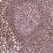 Probable ATP-dependent RNA helicase DDX11 antibody, HPA065197, Atlas Antibodies, Immunohistochemistry frozen image 