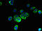 Transmembrane Protein 256 antibody, orb357211, Biorbyt, Immunocytochemistry image 