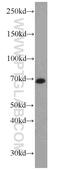 Nucleolar Protein 4 antibody, 14802-1-AP, Proteintech Group, Western Blot image 
