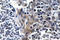 Vasodilator Stimulated Phosphoprotein antibody, LS-C178002, Lifespan Biosciences, Immunohistochemistry frozen image 