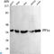 Protein Phosphatase 1 Catalytic Subunit Alpha antibody, LS-C813086, Lifespan Biosciences, Western Blot image 