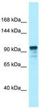 Unc-13 Homolog D antibody, TA337705, Origene, Western Blot image 