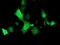 Tropomodulin 1 antibody, MA5-25613, Invitrogen Antibodies, Immunocytochemistry image 