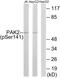 Protein Kinase N2 antibody, PA5-39750, Invitrogen Antibodies, Western Blot image 