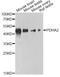 Pyruvate Dehydrogenase E1 Alpha 2 Subunit antibody, A14038, ABclonal Technology, Western Blot image 