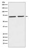 5-Hydroxytryptamine Receptor 2C antibody, M01593-1, Boster Biological Technology, Western Blot image 