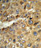 Tyrosine Aminotransferase antibody, LS-C161715, Lifespan Biosciences, Immunohistochemistry frozen image 
