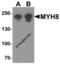 Myosin Heavy Chain 8 antibody, 8081, ProSci Inc, Western Blot image 
