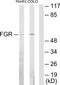 FGR Proto-Oncogene, Src Family Tyrosine Kinase antibody, TA312207, Origene, Western Blot image 