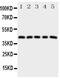 Prostaglandin E Receptor 1 antibody, PA5-79892, Invitrogen Antibodies, Western Blot image 