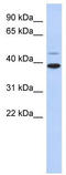 Ring Finger Protein 121 antibody, TA331867, Origene, Western Blot image 
