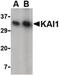 CD82 Molecule antibody, LS-B1346, Lifespan Biosciences, Western Blot image 