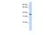 Olfactory Receptor Family 13 Subfamily C Member 5 antibody, A15809, Boster Biological Technology, Western Blot image 