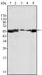 LYN Proto-Oncogene, Src Family Tyrosine Kinase antibody, abx011096, Abbexa, Enzyme Linked Immunosorbent Assay image 