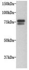 5-Hydroxytryptamine Receptor 2C antibody, orb195512, Biorbyt, Western Blot image 